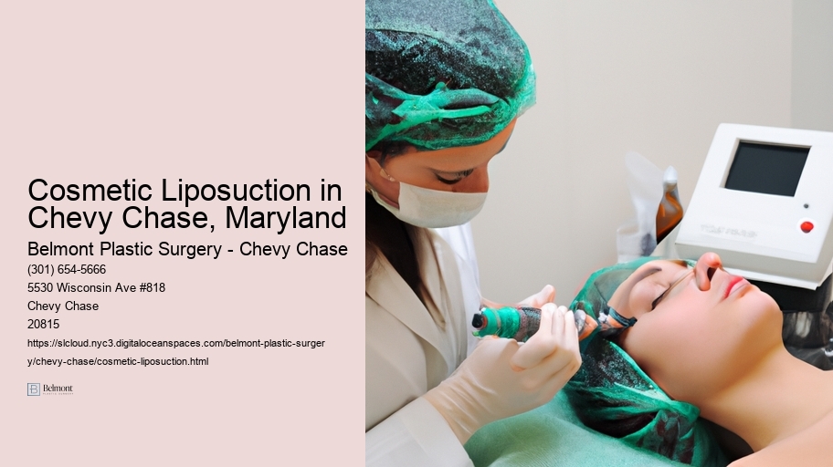 Cosmetic Liposuction in Chevy Chase, Maryland