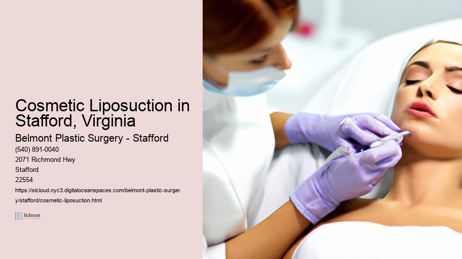 Cosmetic Liposuction in Stafford, Virginia