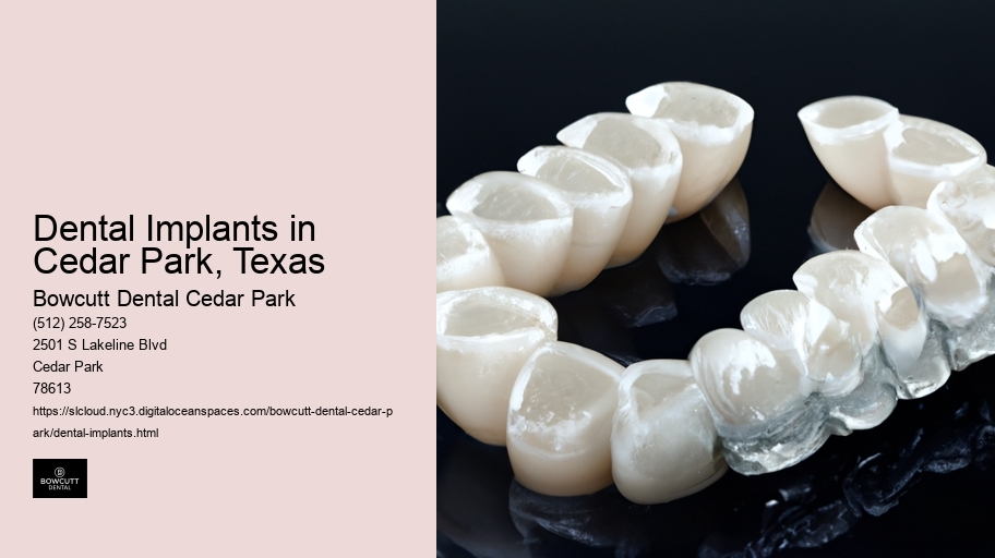Dental Implants in Cedar Park, Texas