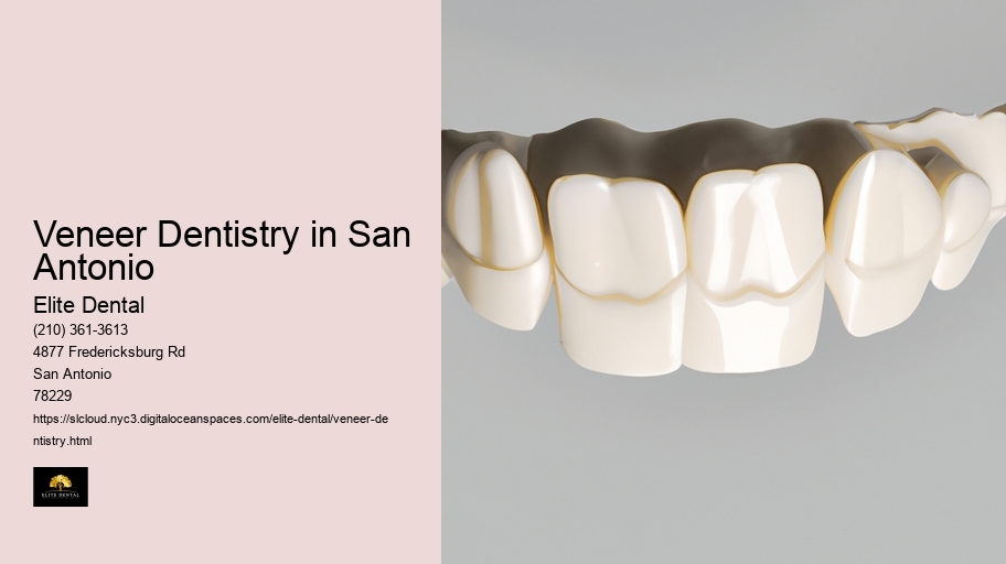 Veneer Dentistry in San Antonio