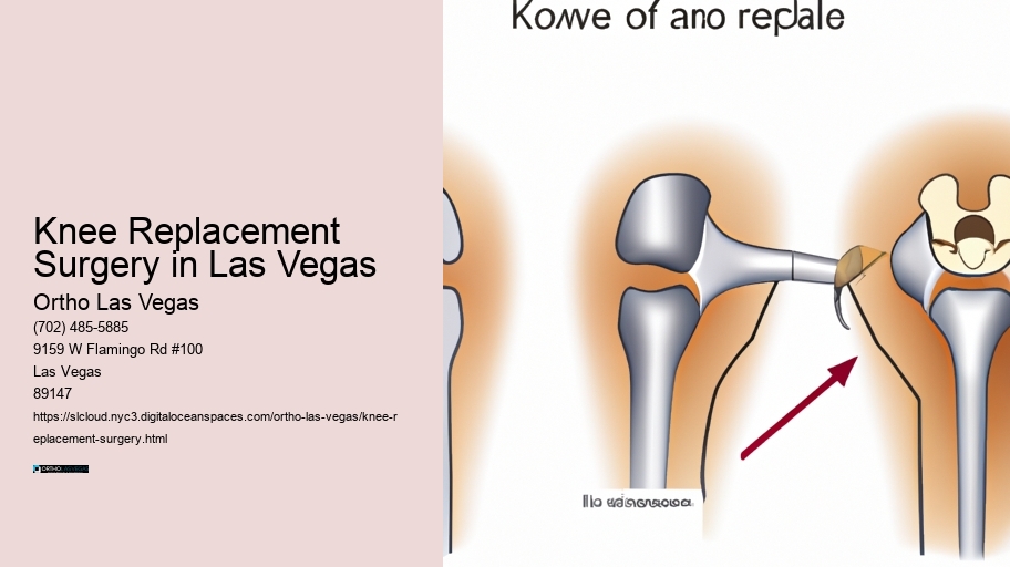 Knee Replacement Surgery in Las Vegas